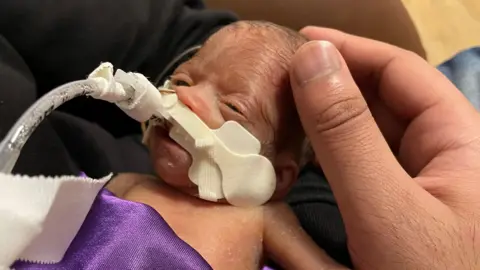 Family handout Mother's hand cradles premature baby's head