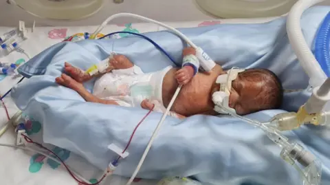 Family handout Premature baby lying in incubator on hospital ward