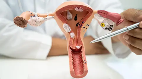 Getty Images Doctor using anatomical model to point out the cervix