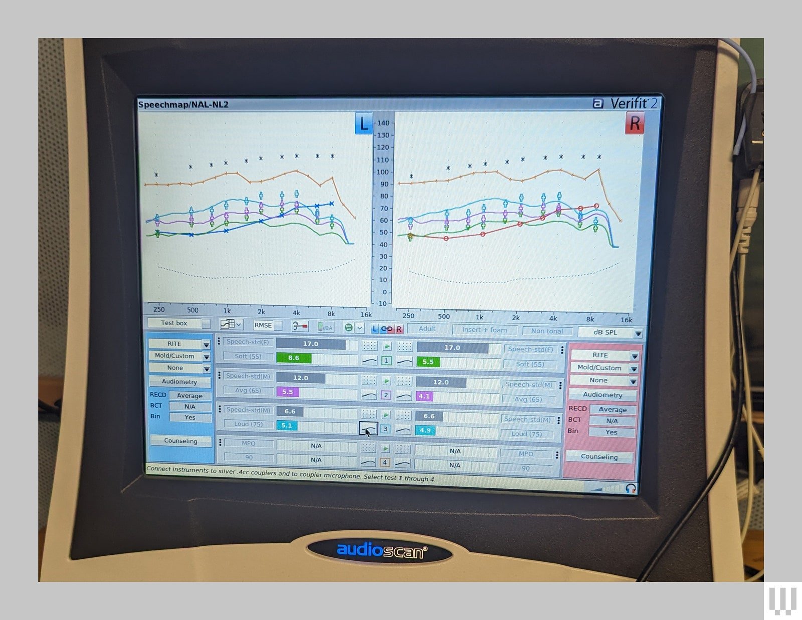 Screen showing separate audiometrics for calibrating and testing left and right hearing aids