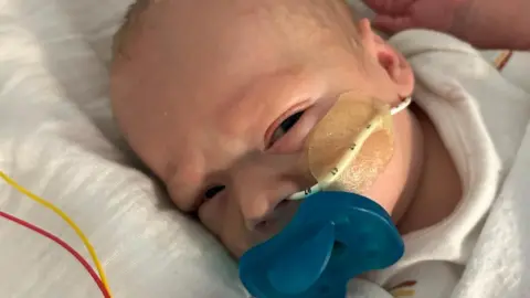 Supplied Baby Milo with a white feeding tube and blue dummy, lying on a hospital bed